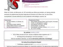 Caso02-Palpitaciones